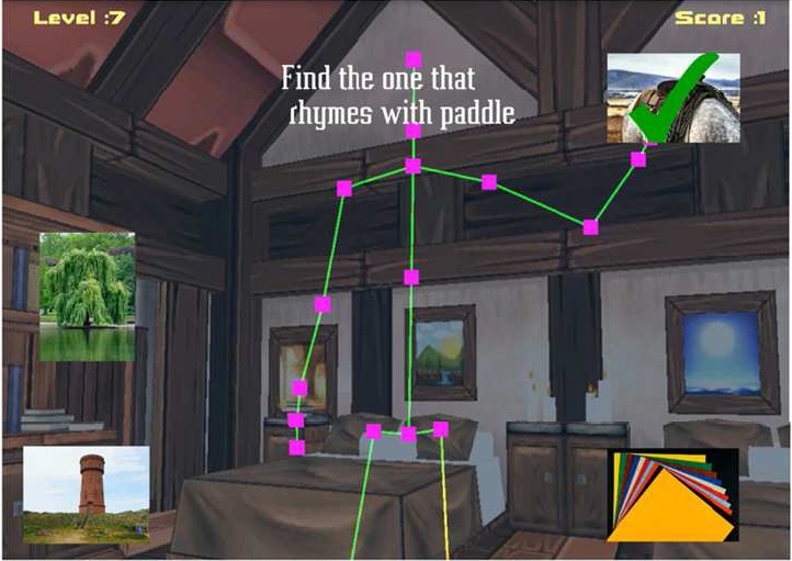 Gaming therapy helps stroke patients recover